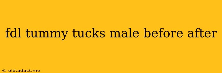 fdl tummy tucks male before after