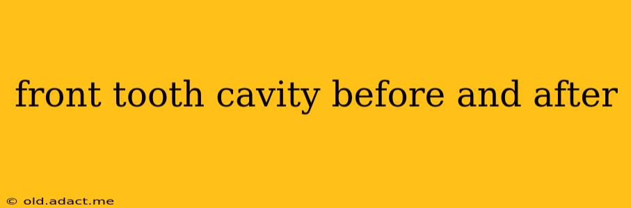 front tooth cavity before and after