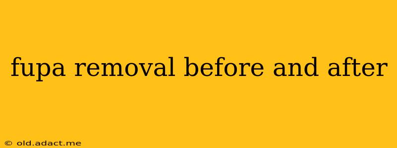 fupa removal before and after