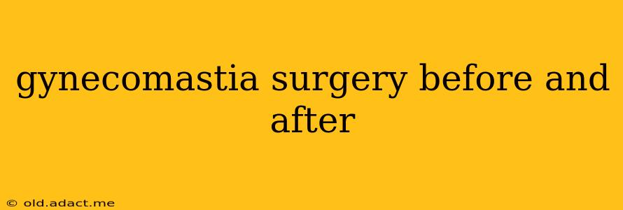 gynecomastia surgery before and after