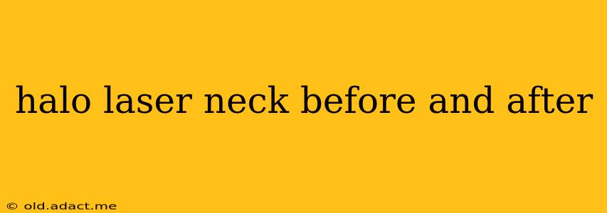 halo laser neck before and after