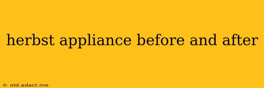 herbst appliance before and after