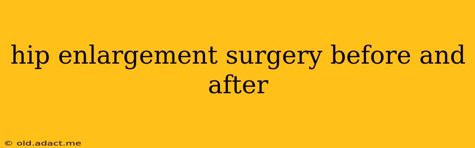 hip enlargement surgery before and after