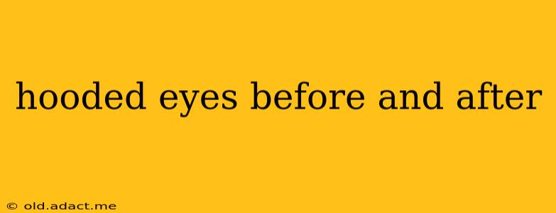 hooded eyes before and after