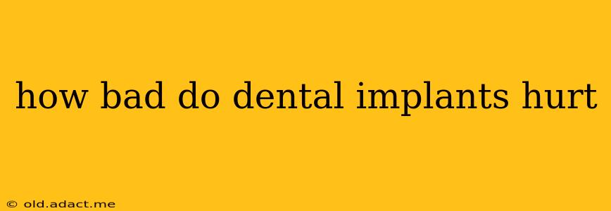 how bad do dental implants hurt