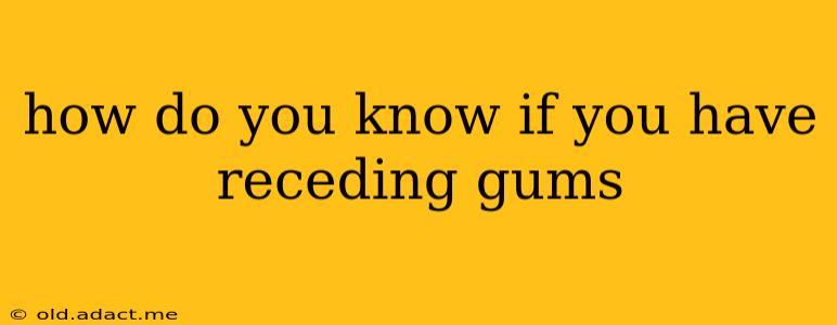how do you know if you have receding gums