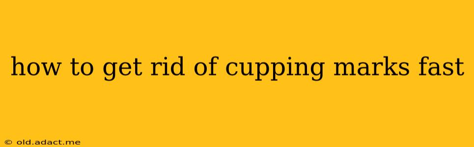 how to get rid of cupping marks fast