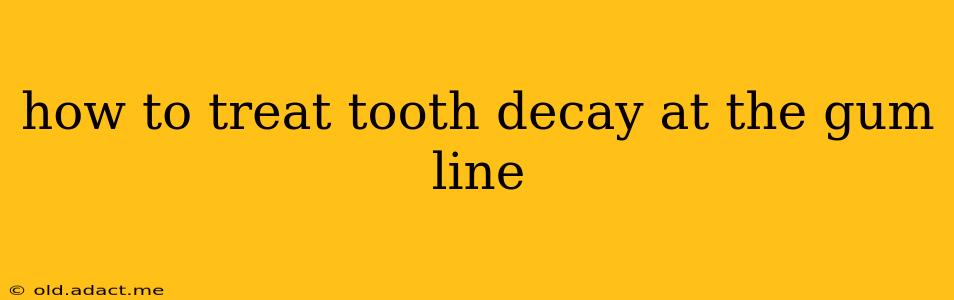 how to treat tooth decay at the gum line