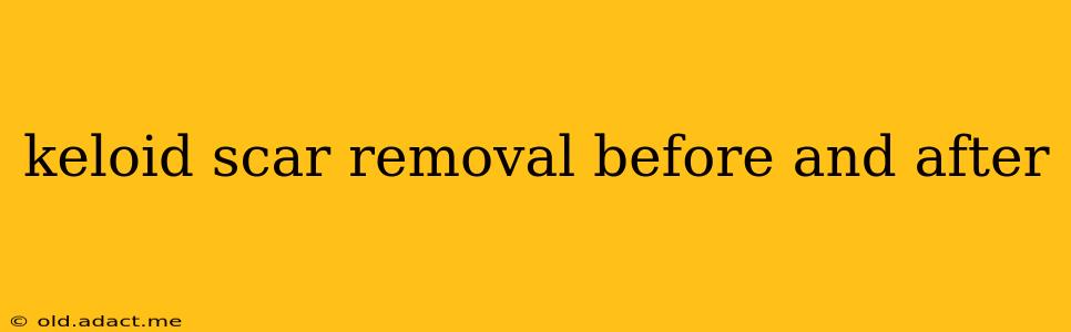 keloid scar removal before and after