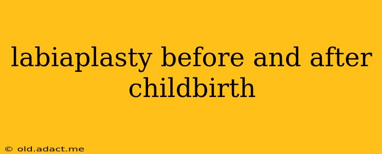 labiaplasty before and after childbirth
