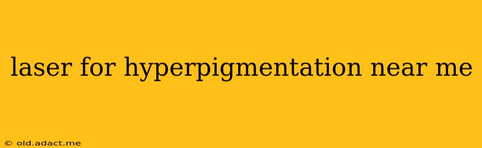 laser for hyperpigmentation near me