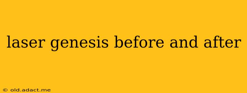 laser genesis before and after