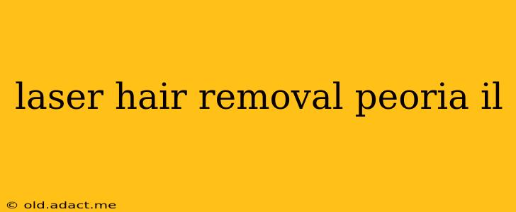 laser hair removal peoria il