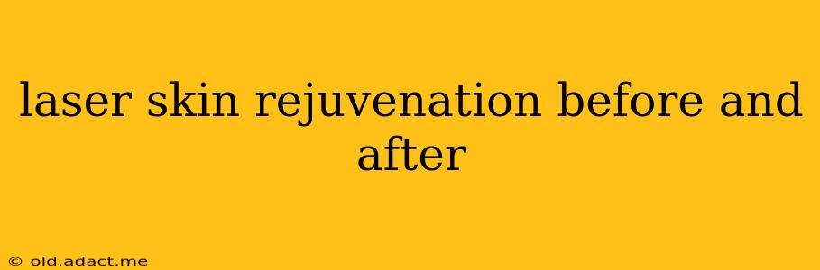 laser skin rejuvenation before and after