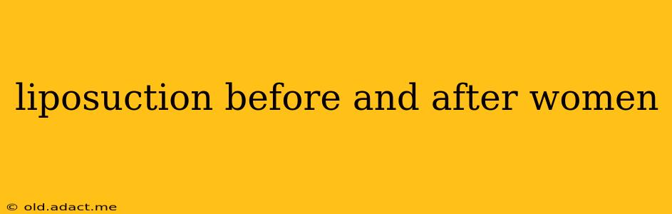 liposuction before and after women