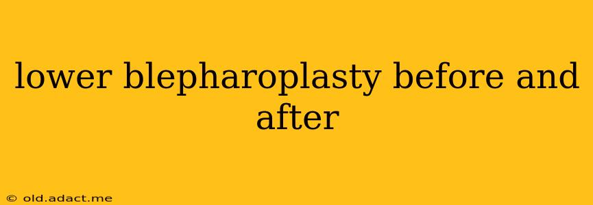 lower blepharoplasty before and after