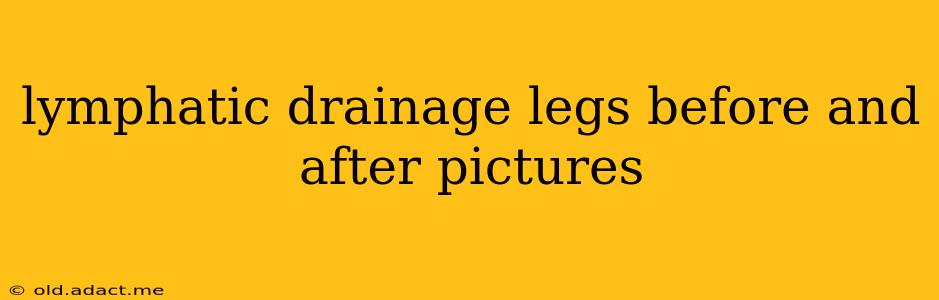 lymphatic drainage legs before and after pictures