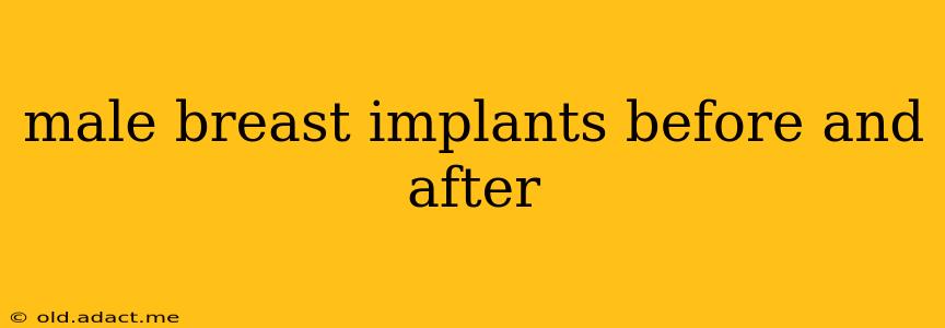 male breast implants before and after