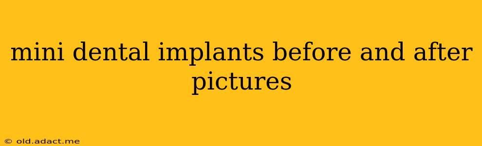 mini dental implants before and after pictures