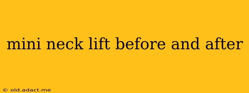 mini neck lift before and after