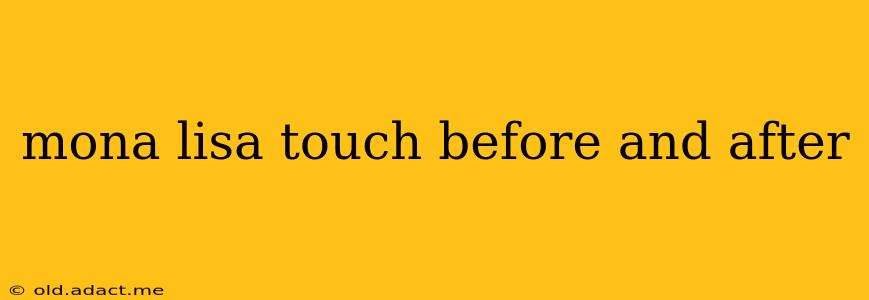 mona lisa touch before and after