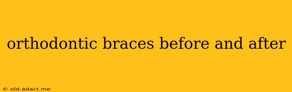 orthodontic braces before and after