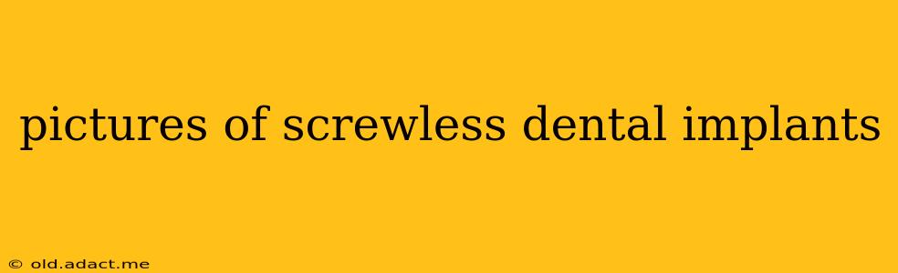 pictures of screwless dental implants