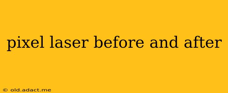 pixel laser before and after
