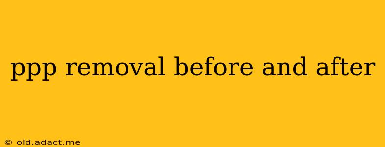 ppp removal before and after