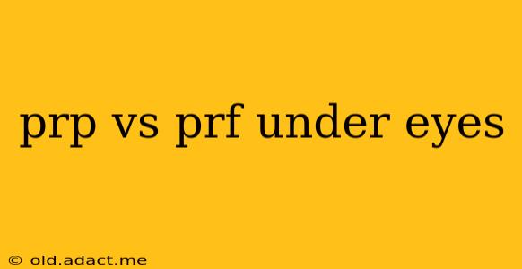 prp vs prf under eyes