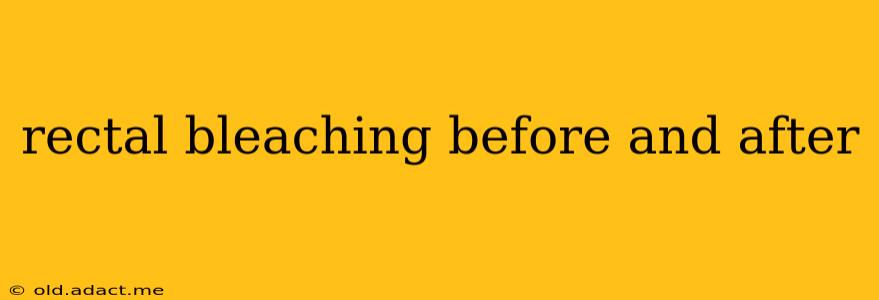rectal bleaching before and after