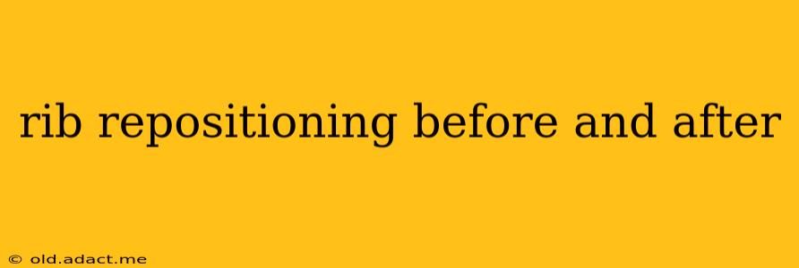 rib repositioning before and after