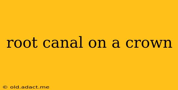 root canal on a crown