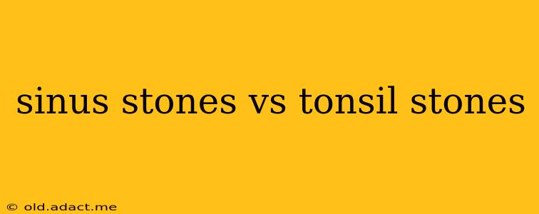 sinus stones vs tonsil stones