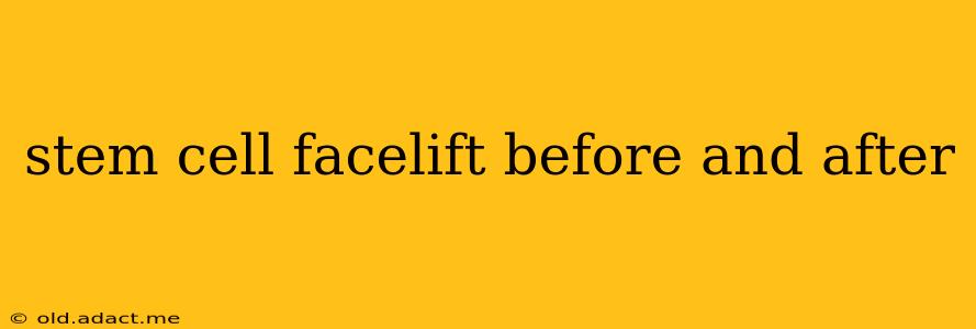stem cell facelift before and after