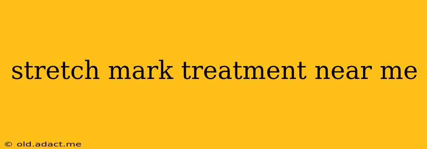 stretch mark treatment near me
