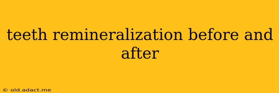 teeth remineralization before and after