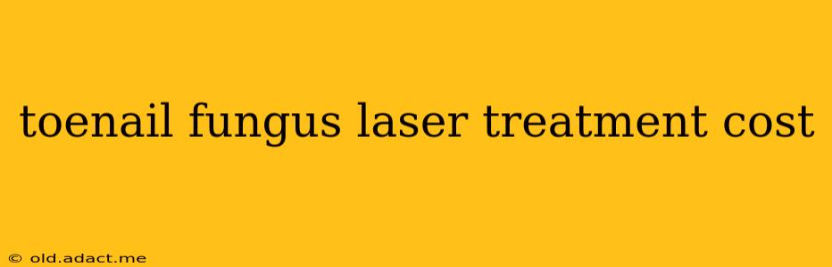 toenail fungus laser treatment cost