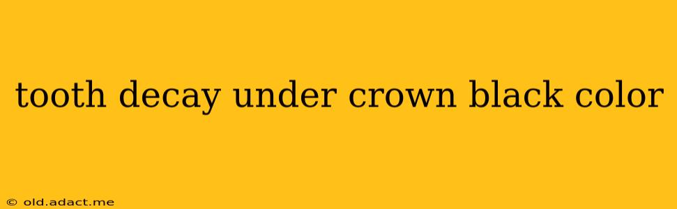 tooth decay under crown black color