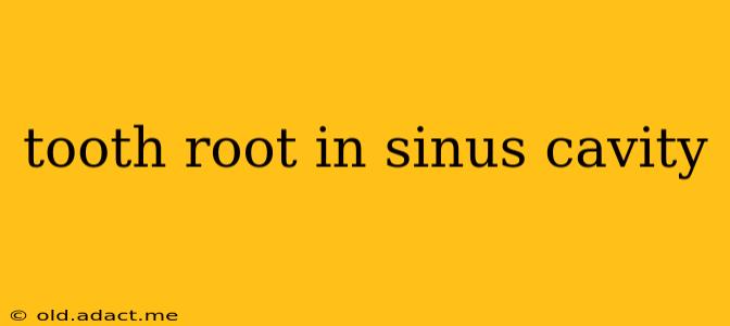 tooth root in sinus cavity