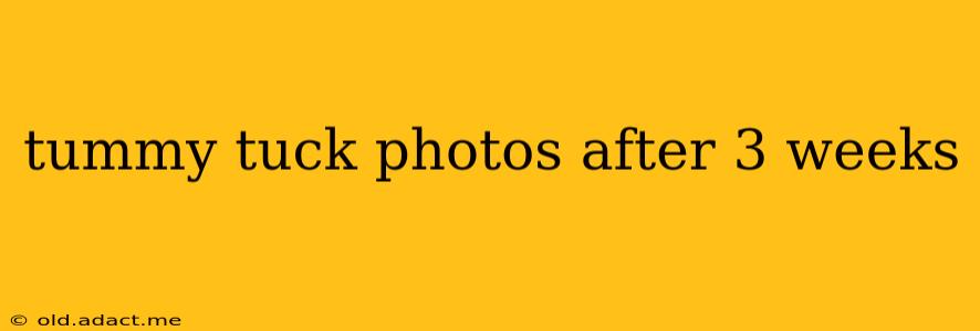 tummy tuck photos after 3 weeks