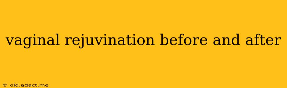 vaginal rejuvination before and after
