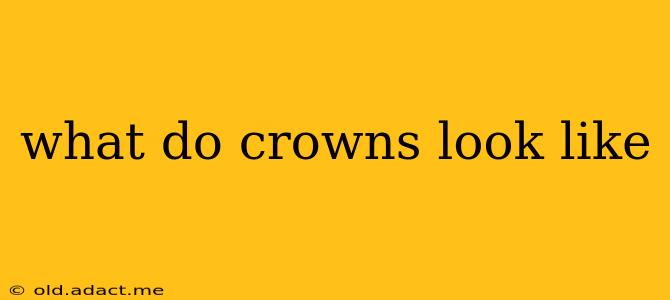 what do crowns look like