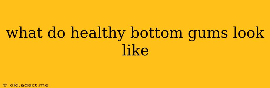 what do healthy bottom gums look like