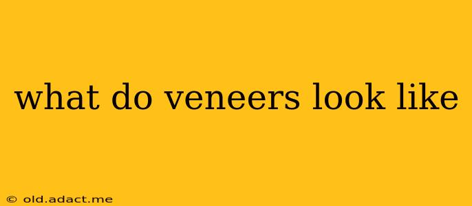 what do veneers look like