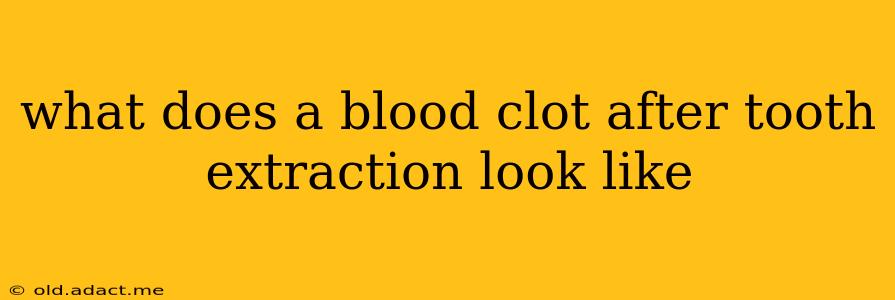 what does a blood clot after tooth extraction look like