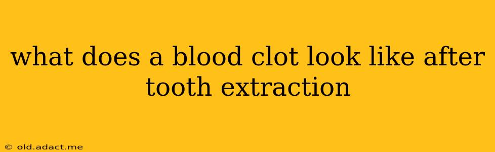 what does a blood clot look like after tooth extraction