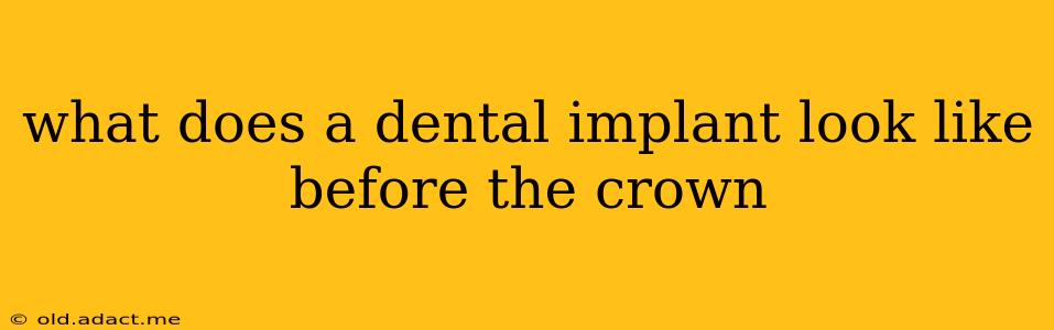 what does a dental implant look like before the crown