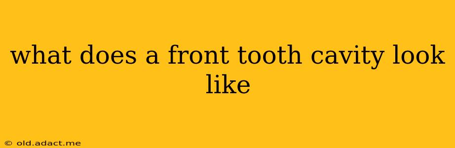 what does a front tooth cavity look like