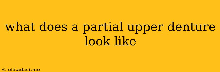 what does a partial upper denture look like